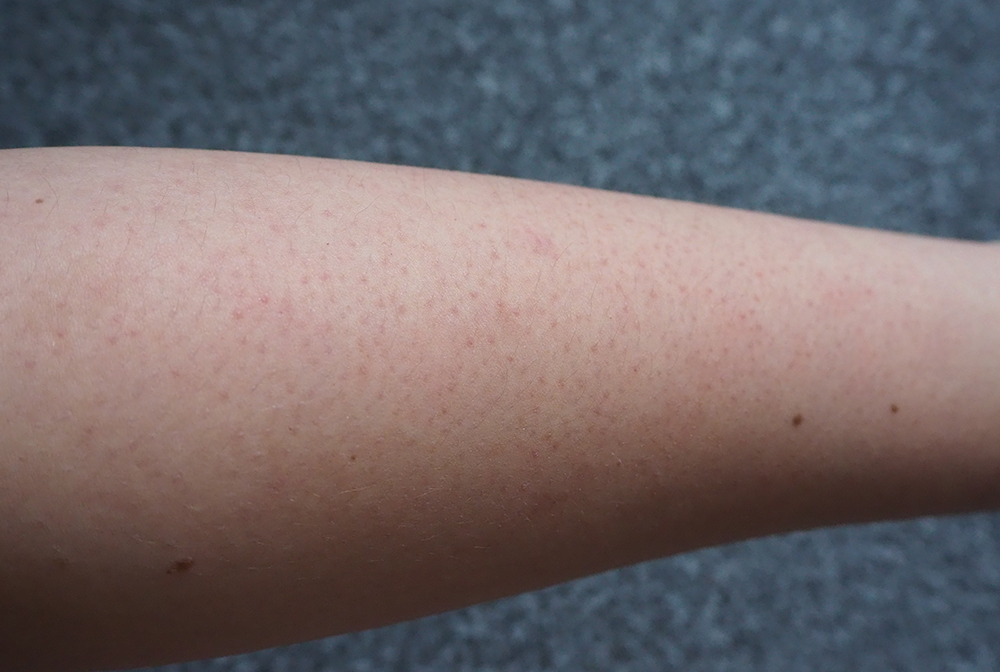 Bali Body Instant Tan before and after image