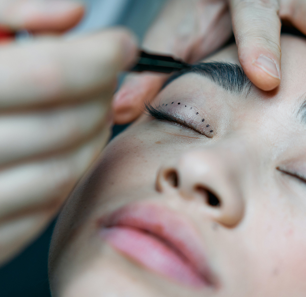 blepharoplasty image