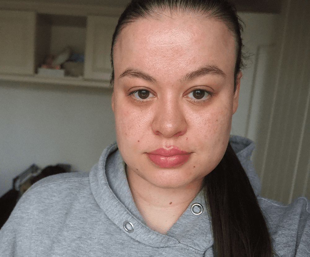 NuFace Mini results image