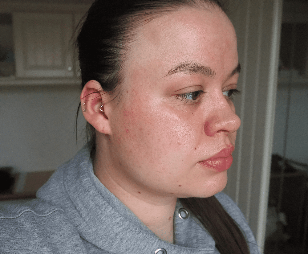 NuFace Mini results image