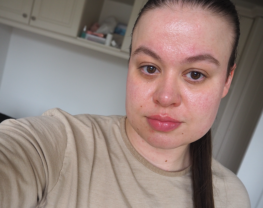 Depology skincare after image