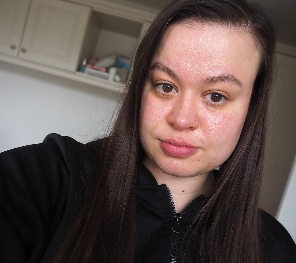 Depology skincare before image